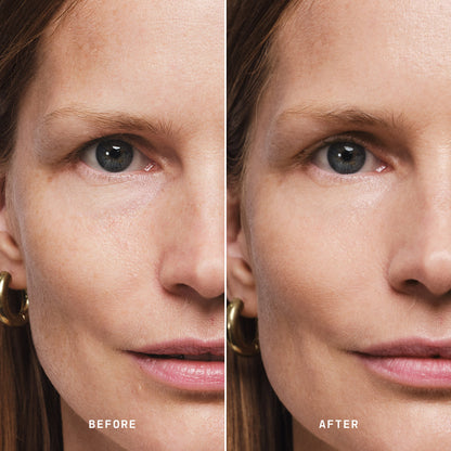 Skin Solution