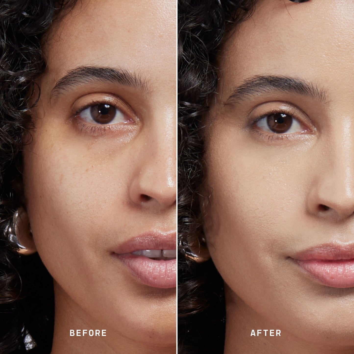 Skin Solution