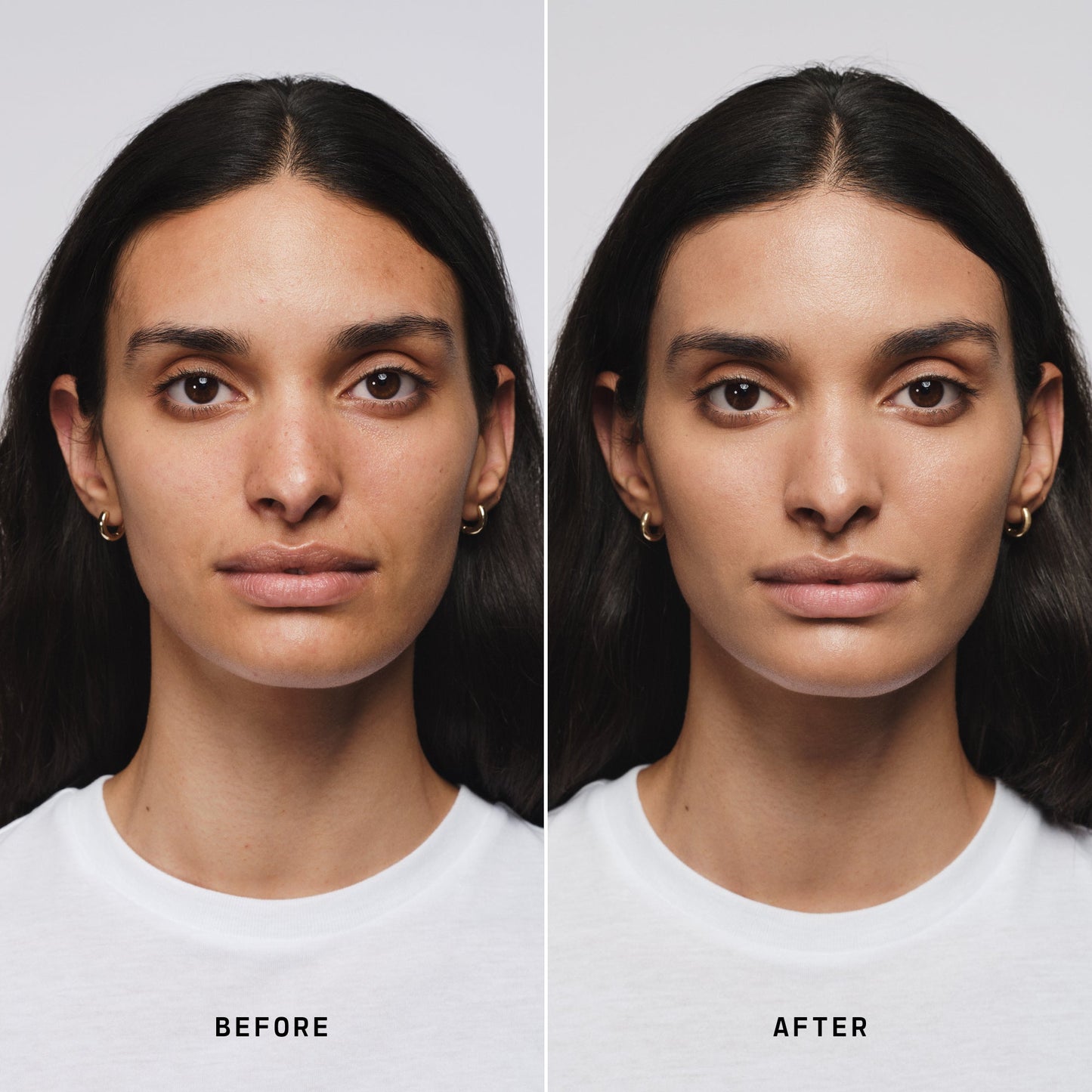 Skin Solution
